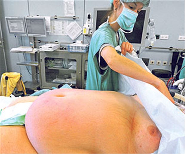 Immer mehr Fettleibige legen sich unters Messer Ein 260 Kilogramm schwerer Patient wird auf eine Operation vorbereitet.