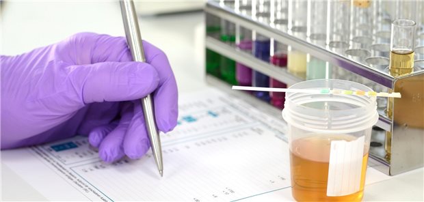 Urinprobe wird im Labor untersucht. Ergebnisse werden schriftlich festgehalten.