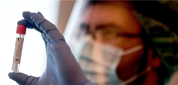 Zahl der PCR-Tests auf SARS-CoV-2 steigt deutlich Ein Arzt aus der Teststelle der Charité hält am Flughafen Berlin-Schönefeld einen Abstrich für einen Coronavirus-Test in der Hand. Die Akkreditierten Labore in der Medizin warnen vor einer zu starken Ausweitung ungezielter Tests bei Reiserückkehrern.