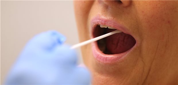Ausnahmekennungen fallen bei SARS-CoV-2-Tests weg Ein Arzt nimmt mit einem Tupfer einen Abstrich bei einer Frau für einen Corona-Test. Ist sie symptomlos, wird nach Testverordnung abgerechnet.