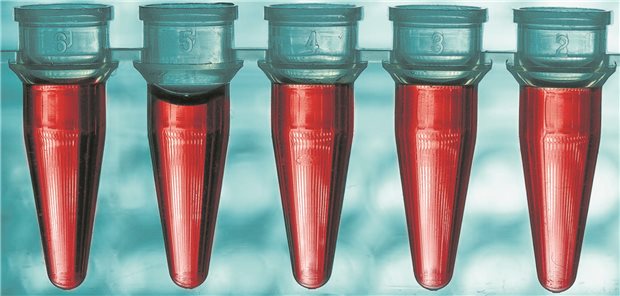 Ein Bluttest könnte die PET-CT bei der Therapieüberwachung bei Melanomen ergänzen.