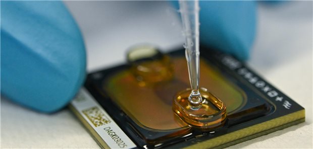 Ein Chip wird für eine Genomsequenzierung beladen. Für die hochmoderne Diagnostik startet nun ein bundesweites Modellvorhaben.