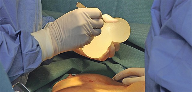 Lymphome als seltene Spätfolgen Ein Chirurg entnimmt ein Silikon-Implantat aus der Brust einer Patientin.