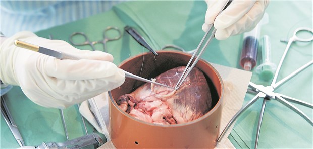 Pavian lebt über ein halbes Jahr mit Schweineherz Ein Chirurg operiert in der Universitätsklinik in Frankfurt am Main an einem Schweineherz (Archivbild). Schweine wären als Organspender besonders geeignet, weil ihr Stoffwechsel dem der Menschen ähnelt.