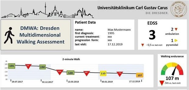 Ein Dashboard zur individuellen Gehanalyse ist Bestandteil des digitalen Zwillings von MS-Patienten am MS-Zentrum der Uniklinik Dresden.