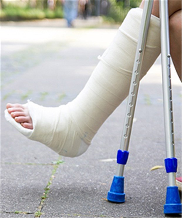 Den Gips kann man sich sparen Ein Gipsverband bringt Patienten mit Achillessehnenriss keine Vorteile. Mit Stützverband können die Patienten ihren Alltag besser bewältigen.