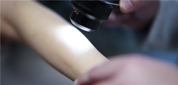 Ein Hautarzt untersucht bei einer Krebsvorsorgeuntersuchung eine Patientin mit einem Auflichtmikroskop: In den vergangenen 20 Jahren hat die Zahl der Krankenhausbehandlungen wegen Hautkrebs stark zugenommen.