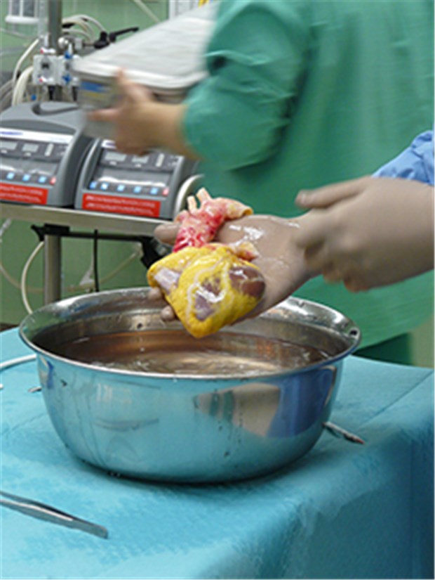 Transplantationsärzte wollen Widerspruchslösung Ein Herz für die Transplantation: Experten drängen darauf, hierzulande die Widerspruchslösung einzuführen.