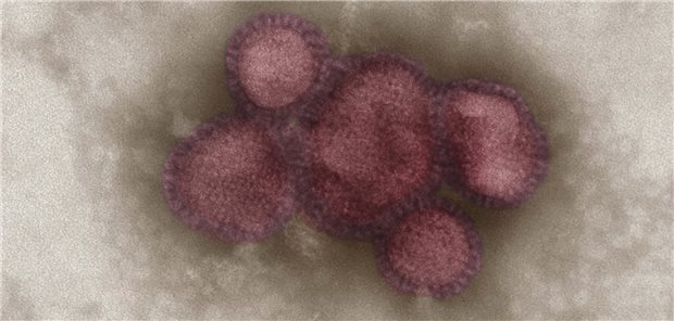 Ein Influenzavirus: Respiratorische Viren kursieren in Deutschland offenbar stärker als zum selben Zeitpunkt der vergangenen Jahre.