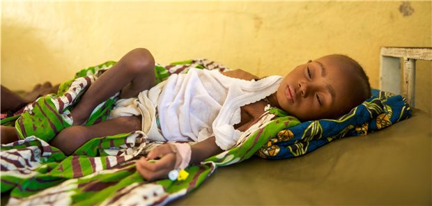 Ein Kind im Krankenhaus von Serabu im Südosten von Sierra Leone (Archivbild). Malaria ist eine der häufigsten Krankheiten in der Region.
