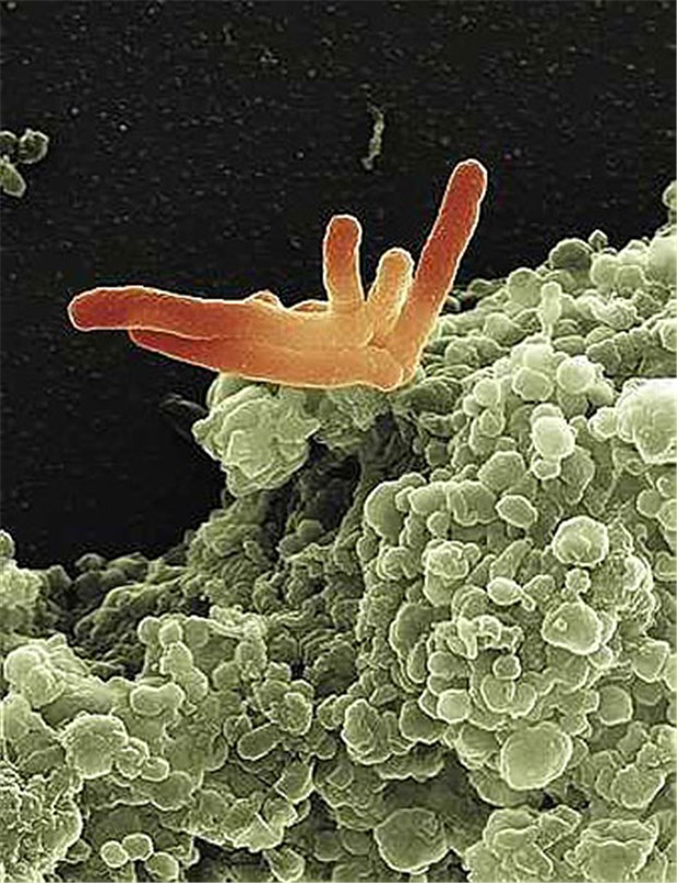 1,8 Millionen Patienten sterben an Tuberkulose Ein Makrophage (grün) macht sich über Tuberkulosebakterien (orange) her. © Volker Brinkmann / Max-Planck-Institut für Infektionsbiologie