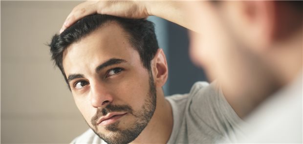 Krankenkassen müssen nicht für Haarwuchsmittel zahlen Ein Mann checkt seine Haare nach Alopecia.