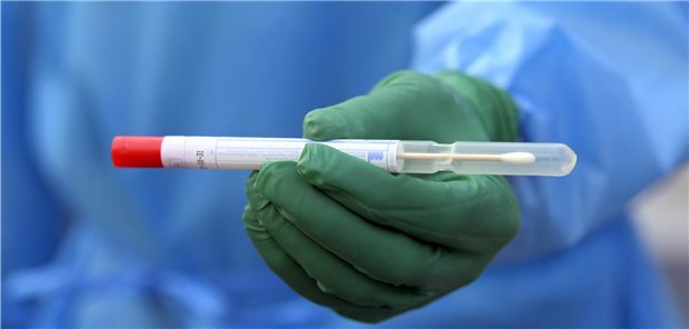 Start frei für Corona-Massentests Ein Mitarbeiter hält ein Abstrichröhrchen für die Corona-Testung in der Hand.