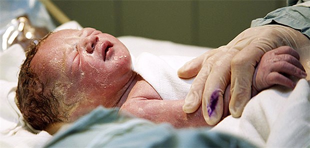 Mit Vaginalsekret das Immunsystem stimulieren Ein Neugeborenes im OP-Kreissaal, direkt nach einer Entbindung per Kaiserschnitt.