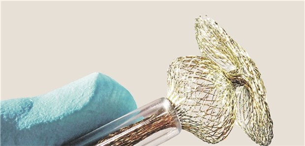 Ein Okkluder. Ein ähnliches Modell kommt beim Verschluss eines offenen Foramen ovale zum Einsatz. Diese Maßnahme ist für manche Migräne-Patienten mit Aura wirksam. Warum genau, bleibt weiter unklar.