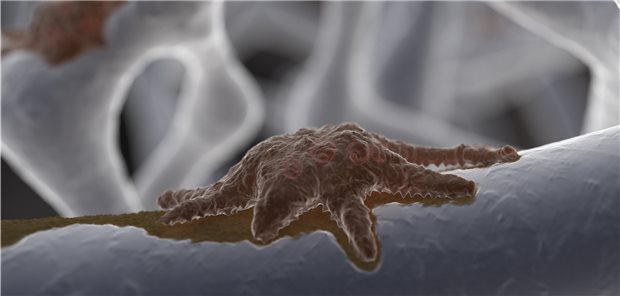 Ein Osteoklast in der Knochensubstanz, um diese zu resorbieren. Ein Prozess, der von Dopamin gefördert.