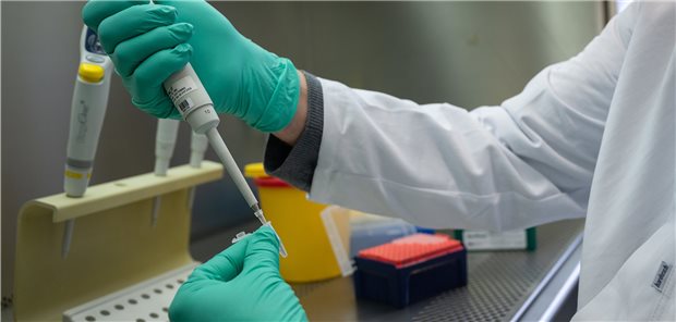 Omikron überwiegt im Norden deutlich Ein PCR-Test wird für die Analyse auf Mutationen des Coronavirus vorbereitet wird. In Schleswig-Holstein dominiert schon die Omikron-Variante.