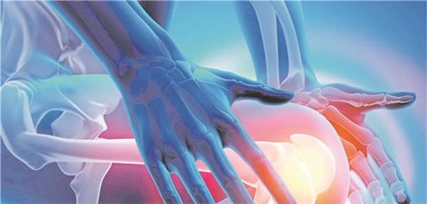 Ein Patient mit schwerem Rheuma? Dann könnte ein ASV-Team übernehmen.