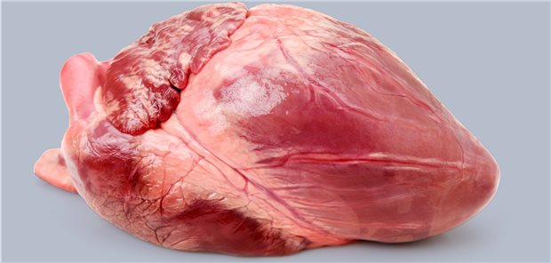 57-Jähriger bekommt Schweineherz transplantiert Ein Schweineherz – ein solches genmodifiziertes Organ wurde einem Herzkranken, der keine Chance mehr auf ein menschliches Spenderherz hatte, transplantiert.