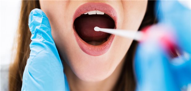 Nahaufnahme eines Arztes, der eine Speichelprobe für einen Mikro-RNA-basierten Test auf Endometriose nimmt.