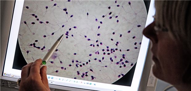 Ein Spermiogramm wird bewertet.