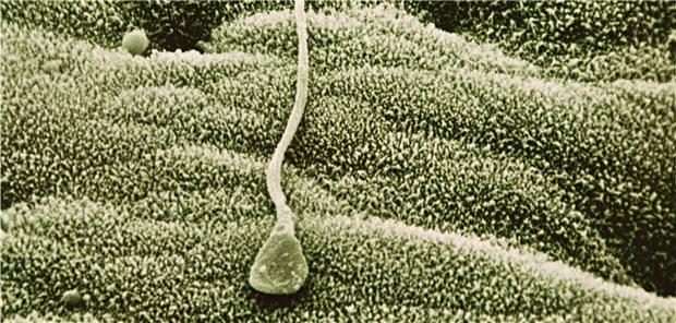 Ein Spermium. Je geringer die Spermatogenese von Teilnehmern einer Studie war, desto höher ihre vorzeitige Sterblichkeit.