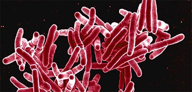 TB-Erreger suchen sich ihre ökologische Nische Ein TB-Erreger unter dem Elektronenmikroskop.