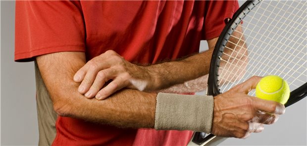 Ein Tennisarm, Epicondylopathia humeri radialis, heilt meist von selbst aus.