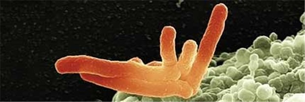 Ein Tuberkulose-Erreger (rot) wird von einem Makrophagen (grün) attackiert.