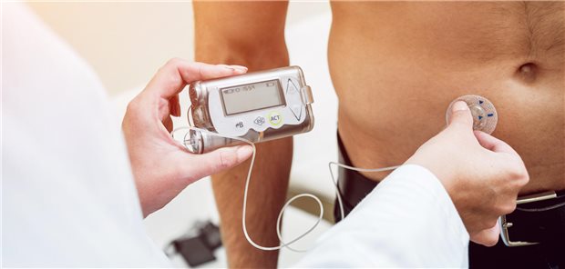 Nahaufnahme einer Ärztin mit einem tragbaren Abgabesystem, das  periumbilikal an den Bauch des Patienten angeschlossen ist und diesem zyklische subkutan ein Medikament verabreicht.