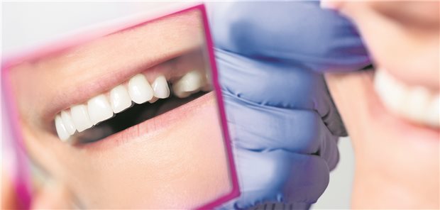 Ein Zahn weniger – Damit es nicht so weit kommt, spielt die interdisziplinäre Zusammenarbeit zwischen Arzt und Zahnarzt unter Einbeziehung der Patientin eine entscheidende Rolle. Denn statistisch gesehen haben bereits 40-jährige Frauen einen Zahn weniger als gleichaltrige Männer (GEK Zahnreport 2011).