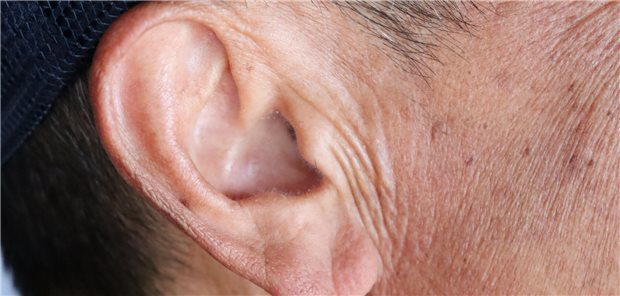 Nahaufnahme der rechten Ohrmuschel eines Mannes.