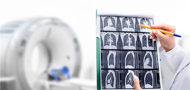 Ein Radiologe, der die Computertomographieaufnahme der Lunge eines Patienten betrachtet. 