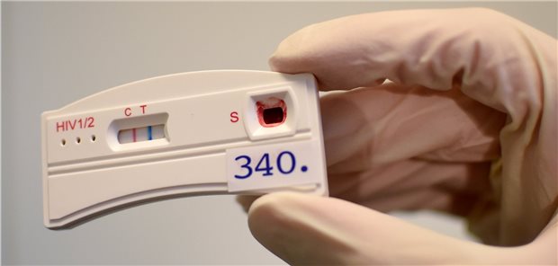 Schnelltests könnten HIV-Inzidenz reduzieren Ein bei der Berliner Aids-Hilfe eingesetzter Schnelltest: Zwei Streifen bedeuten eine HIV-Infektion.