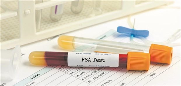 Ein erhöhter PSA-Wert gilt als Risikofaktor für ein Prostata-Ca. Bei welchen Männern sollte eine Prostatabiopsie erfolgen?