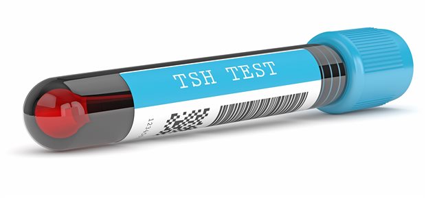 Ein erhöhter TSH-Wert macht noch keine Erkrankung. Es gibt viele Faktoren, die ihn – auch kurzfristig – beeinflussen.