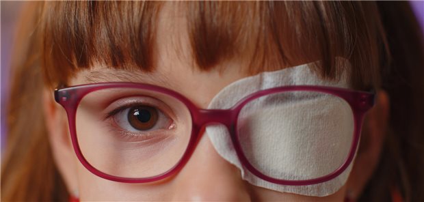 Nahaufnahme der Augenpartie eines Mädchens, das ein Pflaster auf einem Auge trägt. Darstellung der Patching-Therapie (Abkleben des kontralateralen Auges).
