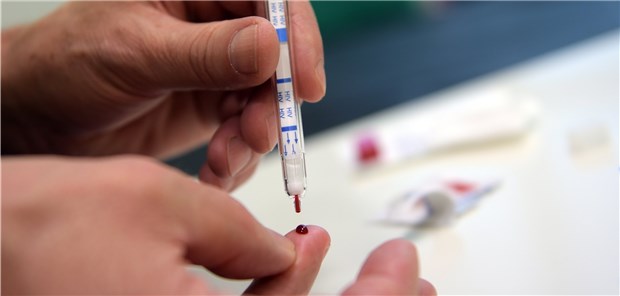 Brandenburger oft ahnungslos Ein junger Mann macht einen HIV-Heimtest. Brandenburgs Gesundheitsministerin ruft dazu auf, diese öfter zu nutzen, um Klarheit zu bekommen.