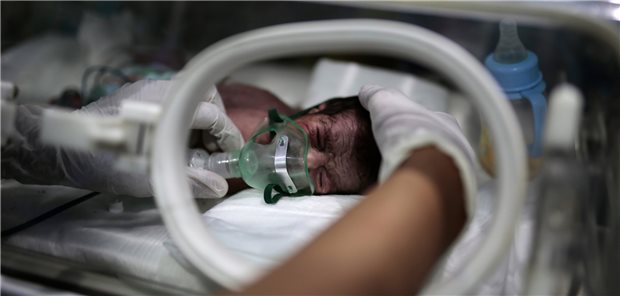Ärzte ohne Grenzen: Immer mehr Kinder im Jemen sind unterernährt Ein medizinischer Mitarbeiter kümmert sich um ein unterernährtes Neugeborenes, das in einem Inkubator im internationalen Krankenhaus UniMax in Sanaa liegt.