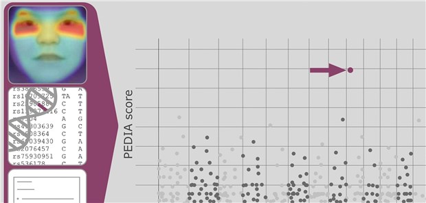 Ein neuronales Netzwerk kombiniert automatisch Porträtfotos mit Gen- und Patientendaten.