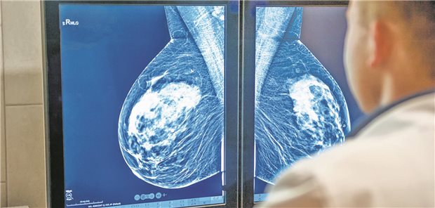Ein Arzt beurteilt die Mammografie-Aufnahme an einem Bildschirm.
