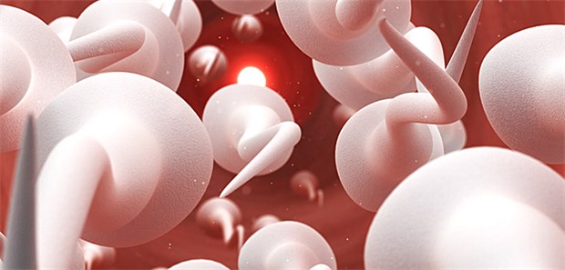 Spermien variieren ihre Schwimmtechnik Ein plakativer Look: Spermien in Bewegung.
