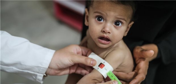 „Sehr deutliche Steigerung“: Hunderte Millionen Menschen leiden unter Hunger Ein syrisches Kind wird im Ibn-Sina-Krankenhaus aufgrund von Unterernährung medizinisch behandelt. Die Welthungerhilfe hat vor einer Zunahme von Hungersnöten gewarnt.