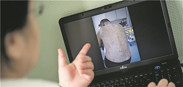 Neue Leitlinien stehen Eine Ärztin zeigt auf ihrem Laptop ein Foto von einem Skabies-Patienten.