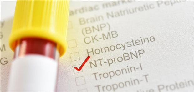 Eine Blutprobe für den NT-proBNP-Test, ein Herzmarker für akute oder chronische Herzinsuffizienz.