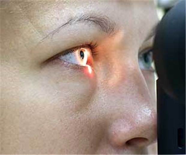 Alzheimer und Multiple Sklerose zeigen sich im Auge Eine Augenuntersuchung kann offenbar früh auf degenerative Erkrankungen hinweisen.