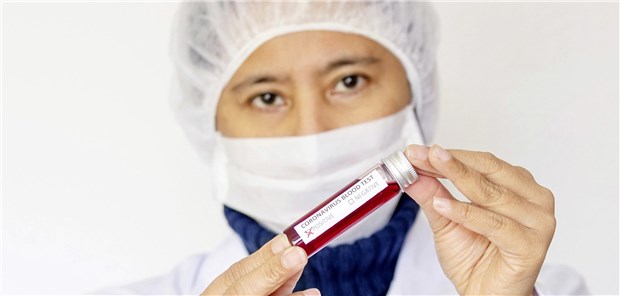 Lungenkrankheit heißt jetzt Covid-19 Eine Blutprobe im Reagenzglas zur Analyse des Coronavirus.