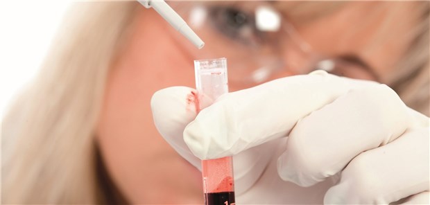 Eine Blutprobe wird bearbeitet. Biomarker könnten auch bei Patienten mit einer fraglichen Commotio cerebri zunehmend interessant werden.