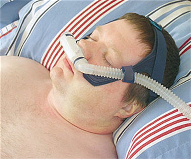 Bei Dauerhusten könnte CPAP helfen Eine CPAP-Therapie wirkt sich offenbar positiv bei Schlafapnoe-assoziiertem Husten aus. © Paul Glover / fotolia.com