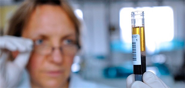 Mit falschen Daten schlechtgeredet? Eine Chemikerin bei der PSA-Wert-Bestimmung.